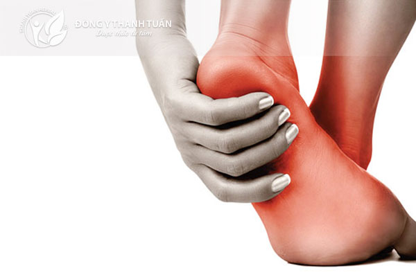 Đau gót chân là biểu hiện của bệnh viêm gan lòng bàn chân