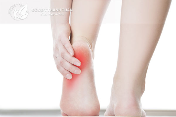 Đau xương gai gót chân là bệnh gây khó khăn trong việc đi lại