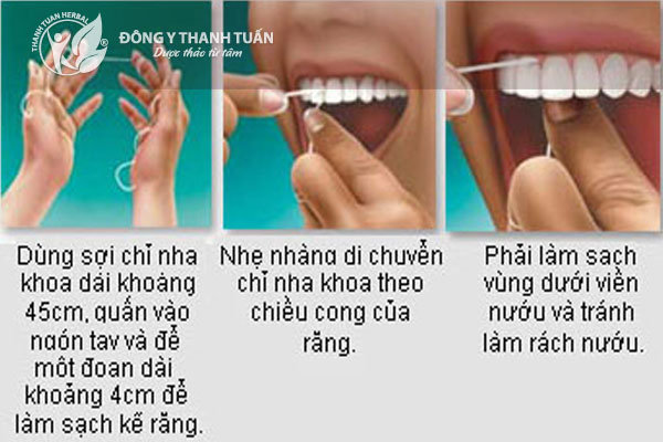 Dùng chỉ nha khoa để vệ sinh răng miệng giúp hơi thở thơm sạch.