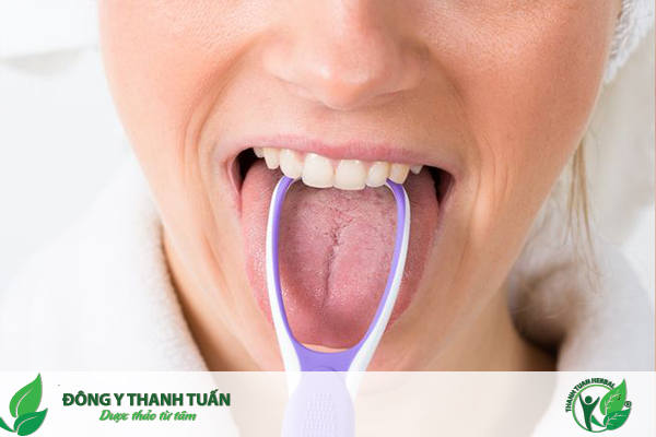 Sử dụng đồ cạo lưỡi để khắc phục tình trạng lưỡi trắng và hôi