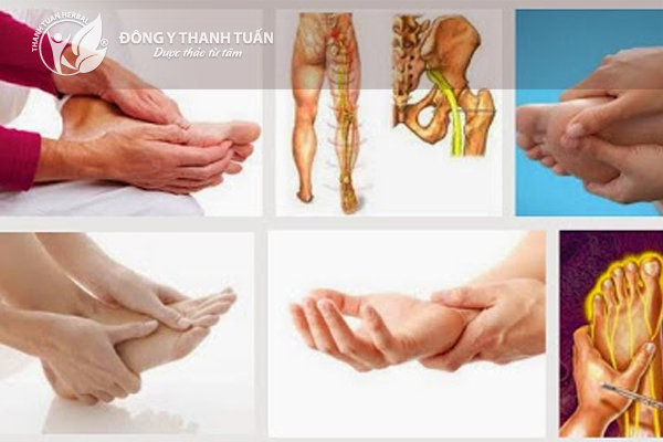 Đau chân, nặng chân là triệu chứng của bệnh lý suy giãn tĩnh mạch.