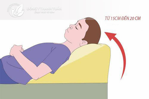 Nâng cao đầu gường khi ngủ là cách điều trị trào ngược axit dạ dày thực quản hiệu quả