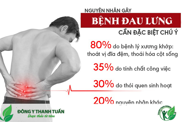Nguyên nhân gây đau lưng