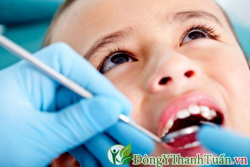 Khám răng định kỳ để phòng ngừa bệnh viêm lợi ở trẻ em