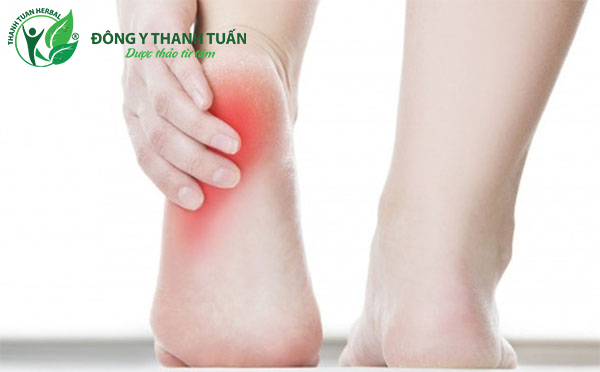  Đau gót chân thường cảm thấy đau dưới chân, về phía trước gót chân